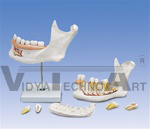 Half Lower Jaw, 3 times full-size, 6 part